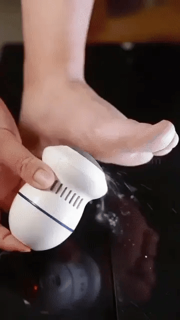 MAQUINA SACA CALLOS RECARGABLE POR USB- ¡PIES SUAVES Y SIN DUREZAS EN SEGUNDOS!